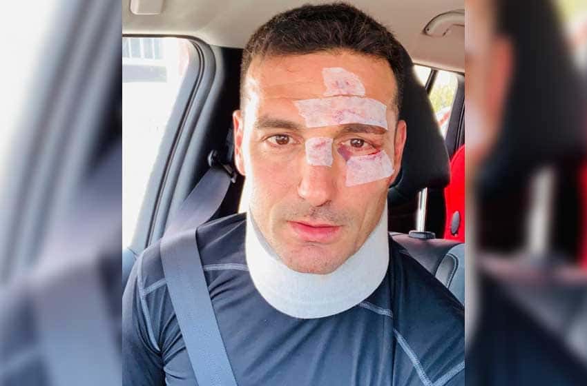 El entrenador de la Selección Argentina de Fútbol sufrió un accidente