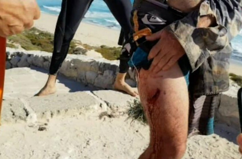 Un surfista argentino fue atacado por un tiburón en Australia