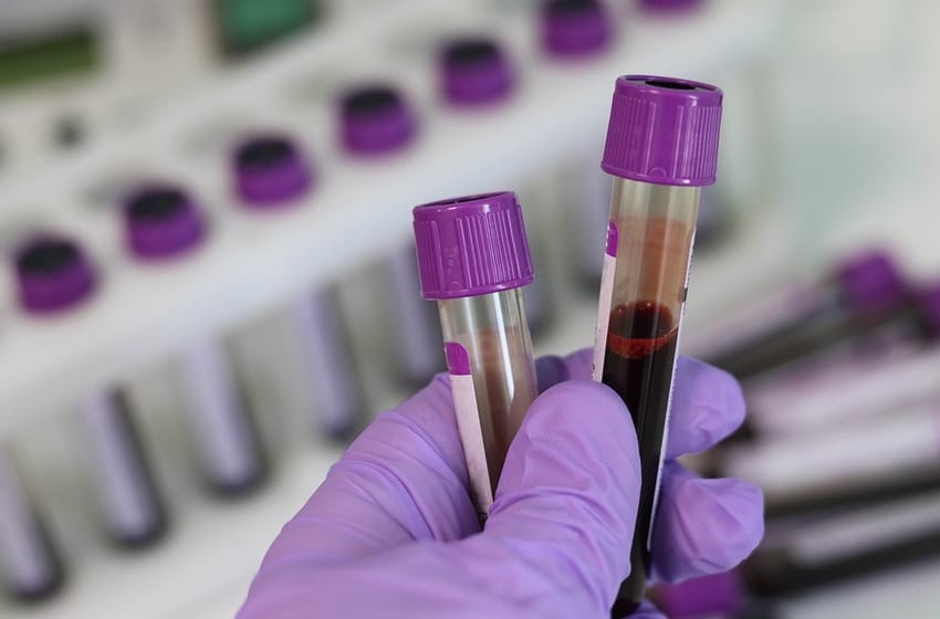 Crean un test de sangre que detecta siete tipos de cáncer