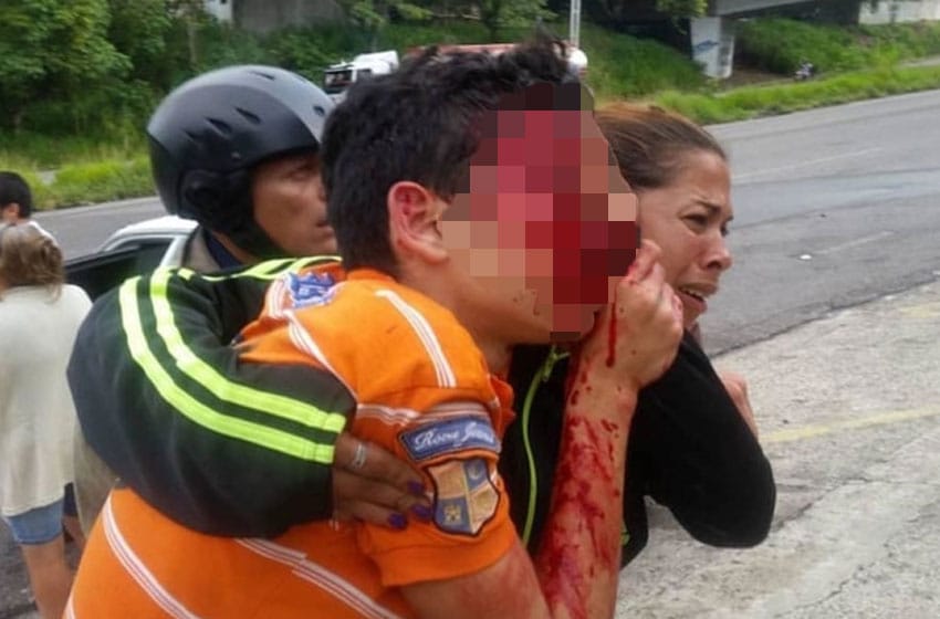 Represión en Venezuela: la brutal agresión que dejó ciego a un adolescente
