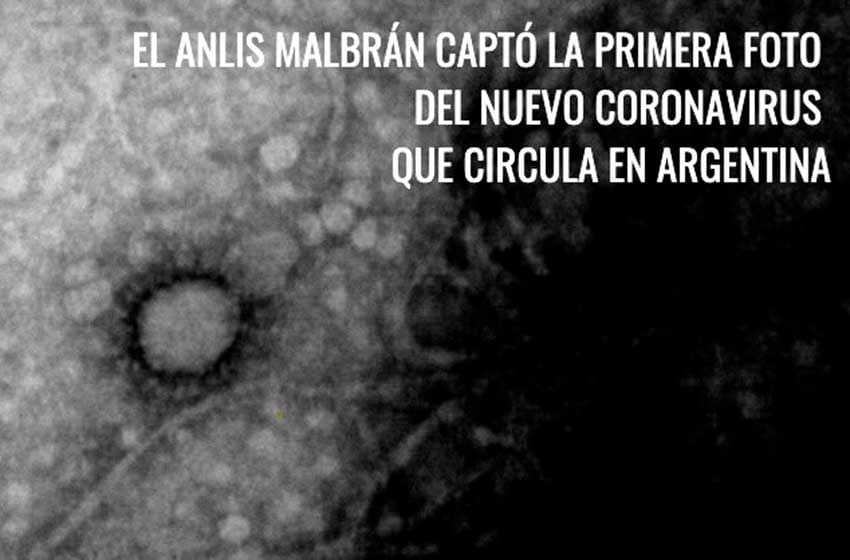 Se conoció la primera foto del Coronavirus que circula en el país
