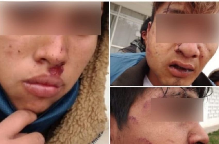 Denuncian que policías chaqueños golpearon y torturaron a integrantes de una familia Qom