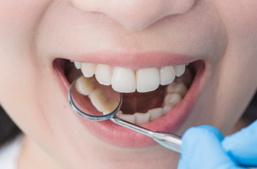 Cuidado dental en niños y adultos