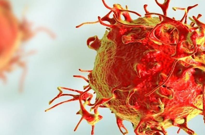 En 30 años el diagnóstico de la leucemia más frecuente en hombres aumentó el 35%