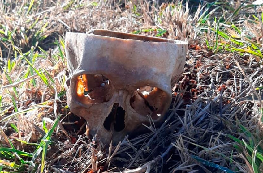 Macabro: encontraron un cráneo humano en el barrio Libertad